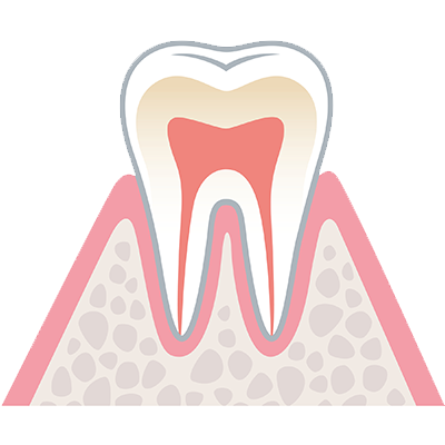 健全な歯 